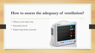 How to assess the adequacy of ventilation?
• Observe for chest rise
• Saturation level
• Improving from cyanosis
 