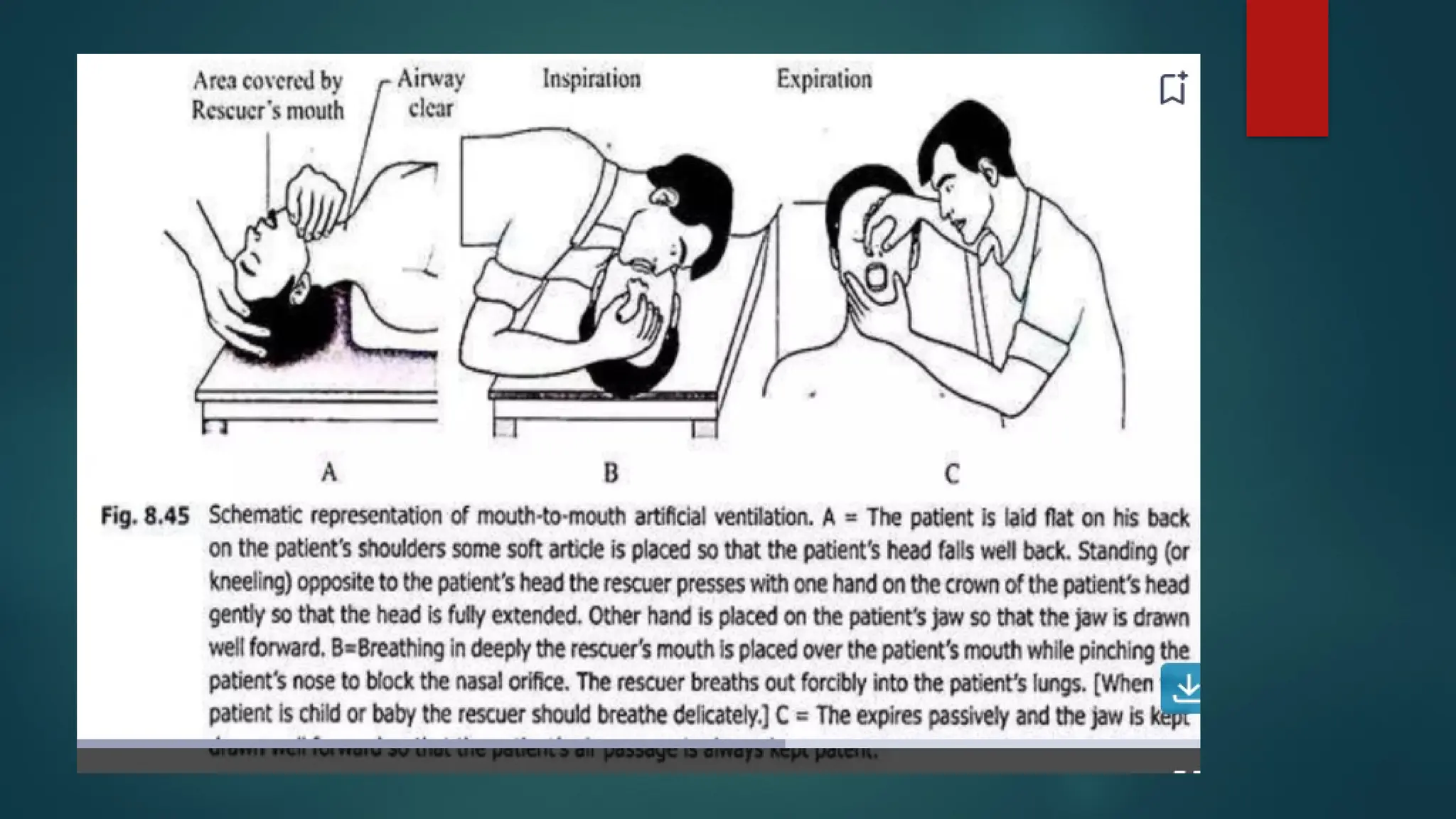 ARTIFICIAL RESPIRATION- POWERPOINT PRESENTATION | PPTX