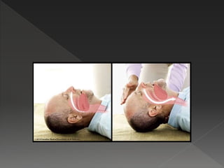 Artificial respiration & cpr