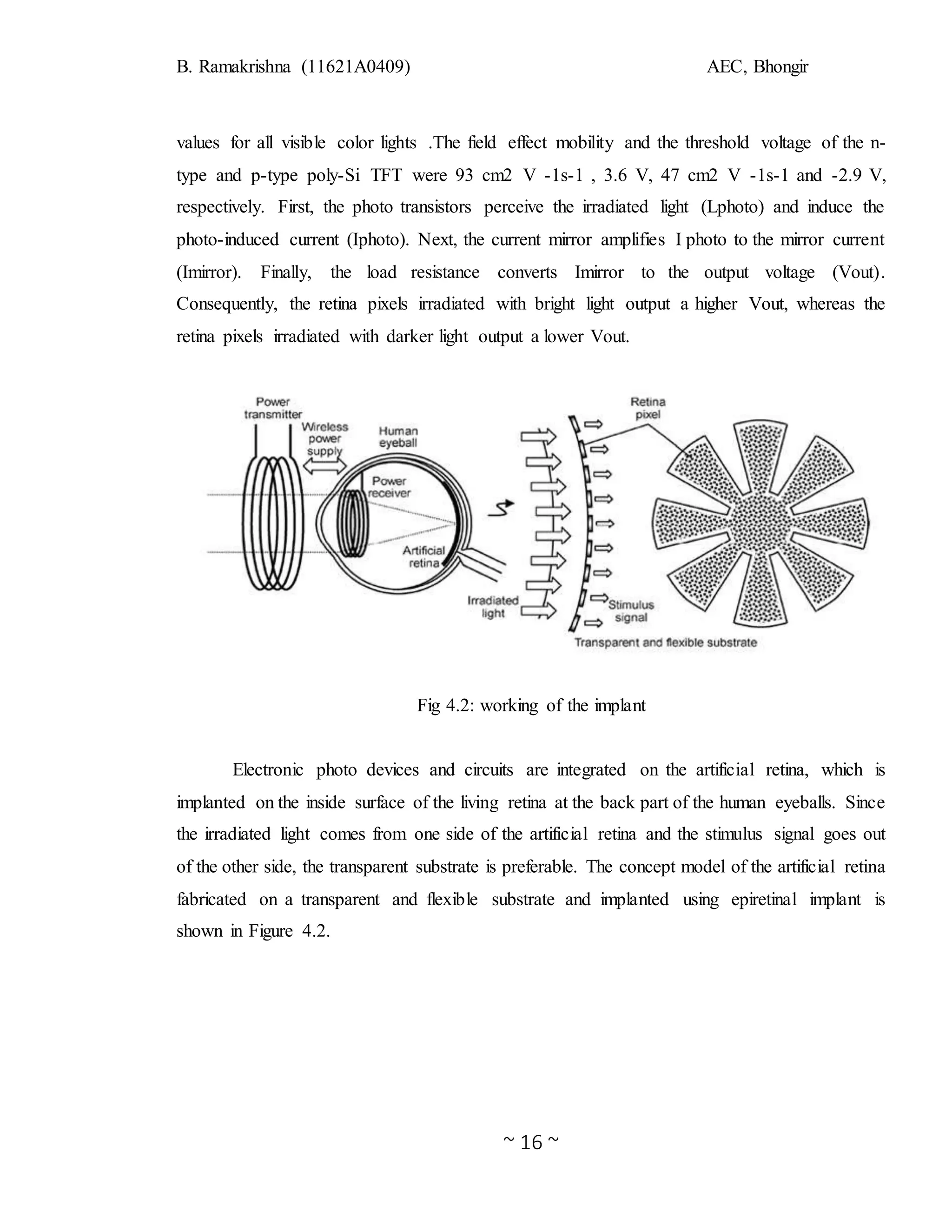B. Ramakrishna (11621A0409) AEC, Bhongir
~ 16 ~
values for all visible color lights .The field effect mobility and the threshold voltage of the n-
type and p-type poly-Si TFT were 93 cm2 V -1s-1 , 3.6 V, 47 cm2 V -1s-1 and -2.9 V,
respectively. First, the photo transistors perceive the irradiated light (Lphoto) and induce the
photo-induced current (Iphoto). Next, the current mirror amplifies I photo to the mirror current
(Imirror). Finally, the load resistance converts Imirror to the output voltage (Vout).
Consequently, the retina pixels irradiated with bright light output a higher Vout, whereas the
retina pixels irradiated with darker light output a lower Vout.
Fig 4.2: working of the implant
Electronic photo devices and circuits are integrated on the artificial retina, which is
implanted on the inside surface of the living retina at the back part of the human eyeballs. Since
the irradiated light comes from one side of the artificial retina and the stimulus signal goes out
of the other side, the transparent substrate is preferable. The concept model of the artificial retina
fabricated on a transparent and flexible substrate and implanted using epiretinal implant is
shown in Figure 4.2.
 