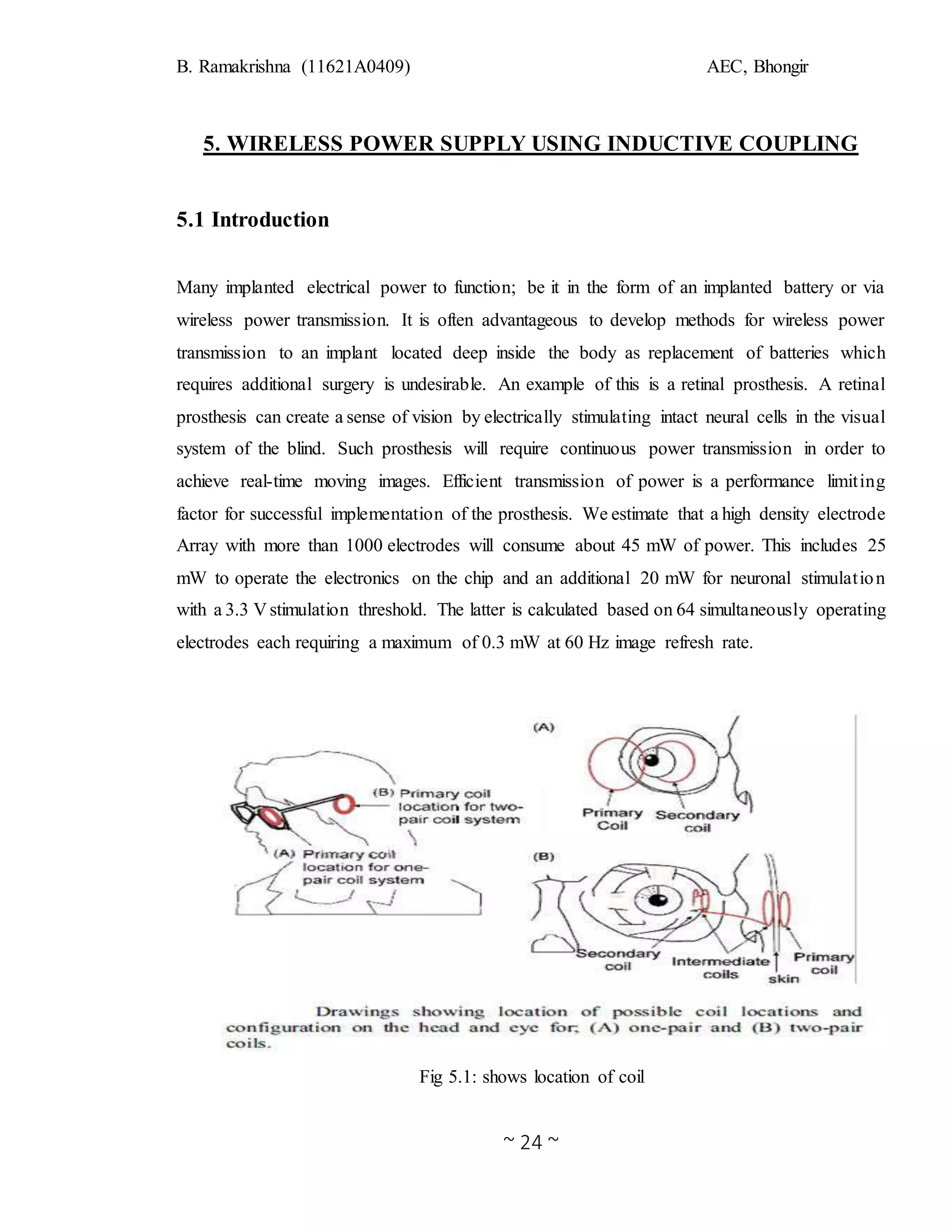 B. Ramakrishna (11621A0409) AEC, Bhongir
~ 24 ~
5. WIRELESS POWER SUPPLY USING INDUCTIVE COUPLING
5.1 Introduction
Many implanted electrical power to function; be it in the form of an implanted battery or via
wireless power transmission. It is often advantageous to develop methods for wireless power
transmission to an implant located deep inside the body as replacement of batteries which
requires additional surgery is undesirable. An example of this is a retinal prosthesis. A retinal
prosthesis can create a sense of vision by electrically stimulating intact neural cells in the visual
system of the blind. Such prosthesis will require continuous power transmission in order to
achieve real-time moving images. Efficient transmission of power is a performance limiting
factor for successful implementation of the prosthesis. We estimate that a high density electrode
Array with more than 1000 electrodes will consume about 45 mW of power. This includes 25
mW to operate the electronics on the chip and an additional 20 mW for neuronal stimulation
with a 3.3 V stimulation threshold. The latter is calculated based on 64 simultaneously operating
electrodes each requiring a maximum of 0.3 mW at 60 Hz image refresh rate.
Fig 5.1: shows location of coil
 