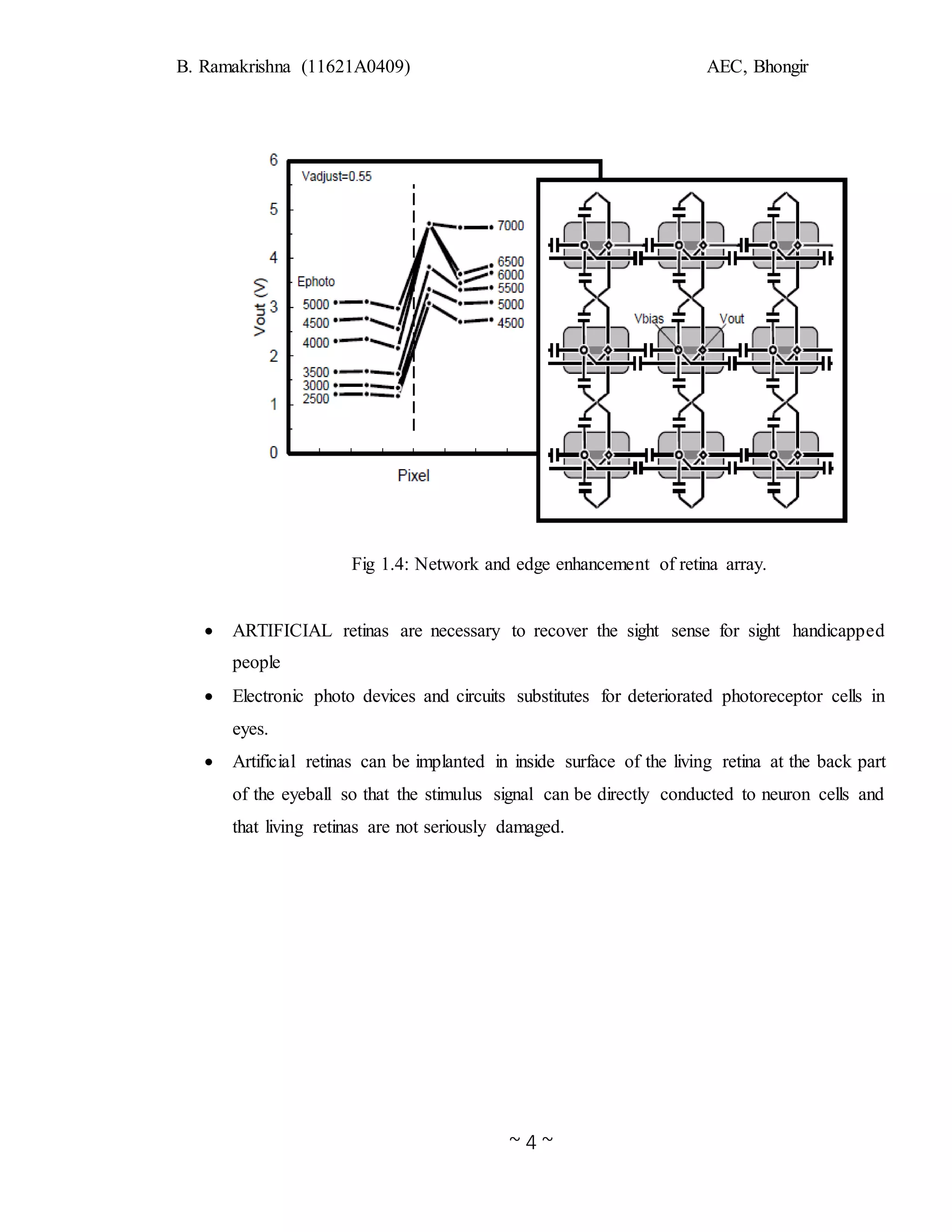 B. Ramakrishna (11621A0409) AEC, Bhongir
~ 4 ~
Fig 1.4: Network and edge enhancement of retina array.
 ARTIFICIAL retinas are necessary to recover the sight sense for sight handicapped
people
 Electronic photo devices and circuits substitutes for deteriorated photoreceptor cells in
eyes.
 Artificial retinas can be implanted in inside surface of the living retina at the back part
of the eyeball so that the stimulus signal can be directly conducted to neuron cells and
that living retinas are not seriously damaged.
 