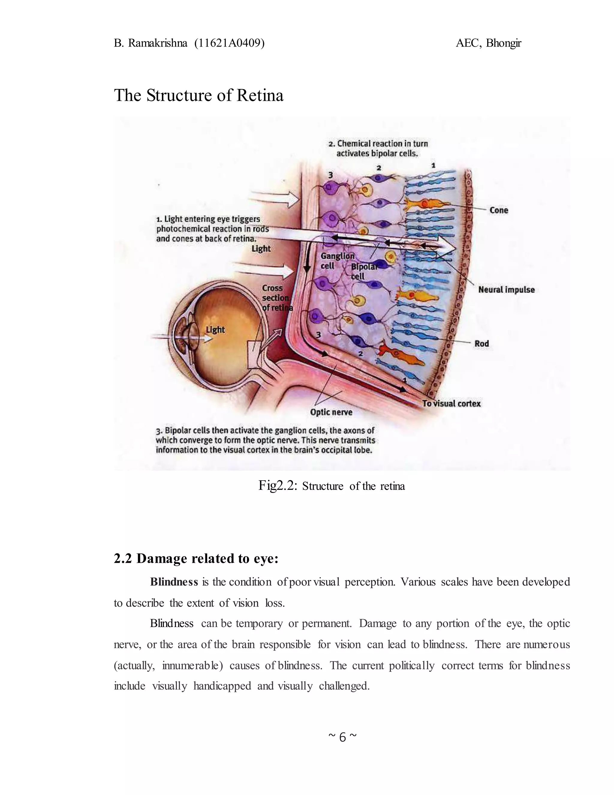 B. Ramakrishna (11621A0409) AEC, Bhongir
~ 6 ~
The Structure of Retina
Fig2.2: Structure of the retina
2.2 Damage related to eye:
Blindness is the condition of poor visual perception. Various scales have been developed
to describe the extent of vision loss.
Blindness can be temporary or permanent. Damage to any portion of the eye, the optic
nerve, or the area of the brain responsible for vision can lead to blindness. There are numerous
(actually, innumerable) causes of blindness. The current politically correct terms for blindness
include visually handicapped and visually challenged.
 