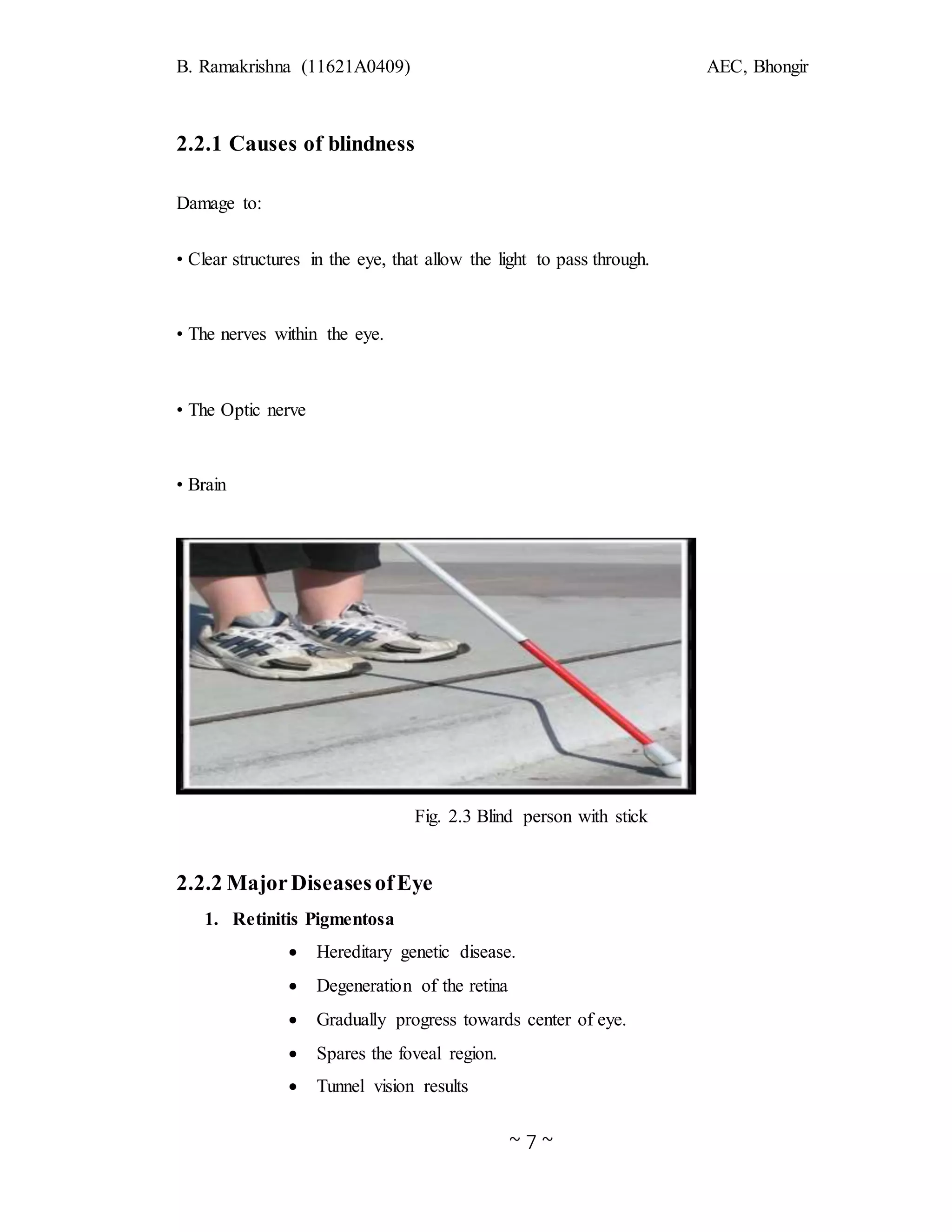 B. Ramakrishna (11621A0409) AEC, Bhongir
~ 7 ~
2.2.1 Causes of blindness
Damage to:
• Clear structures in the eye, that allow the light to pass through.
• The nerves within the eye.
• The Optic nerve
• Brain
Fig. 2.3 Blind person with stick
2.2.2 MajorDiseasesofEye
1. Retinitis Pigmentosa
 Hereditary genetic disease.
 Degeneration of the retina
 Gradually progress towards center of eye.
 Spares the foveal region.
 Tunnel vision results
 