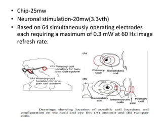 Eye Transistor Artificial retina using thin film transistor technology | PPTX