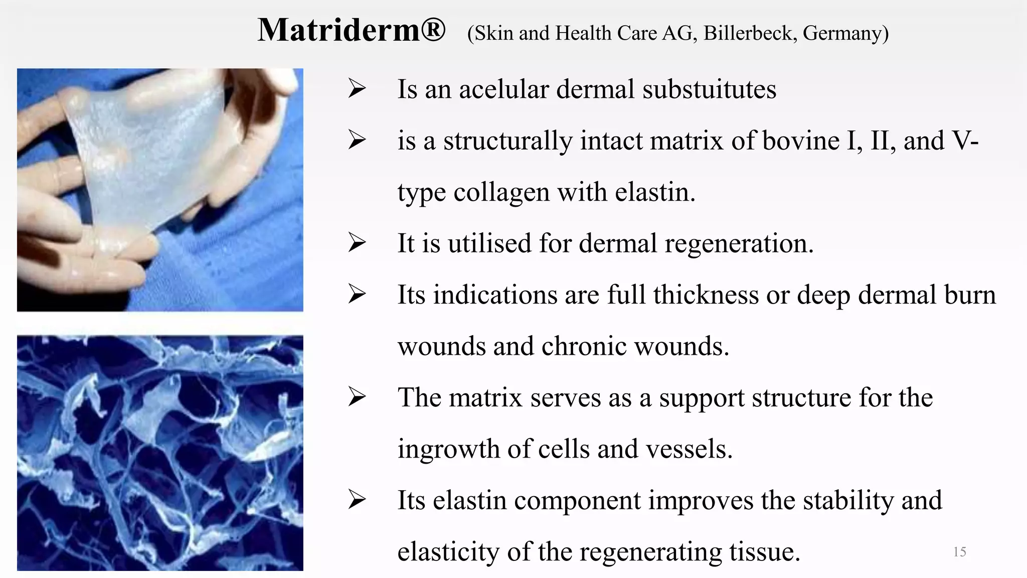 15
Matriderm®
 Is an acelular dermal substuitutes
 is a structurally intact matrix of bovine I, II, and V-
type collagen with elastin.
 It is utilised for dermal regeneration.
 Its indications are full thickness or deep dermal burn
wounds and chronic wounds.
 The matrix serves as a support structure for the
ingrowth of cells and vessels.
 Its elastin component improves the stability and
elasticity of the regenerating tissue.
(Skin and Health Care AG, Billerbeck, Germany)
 