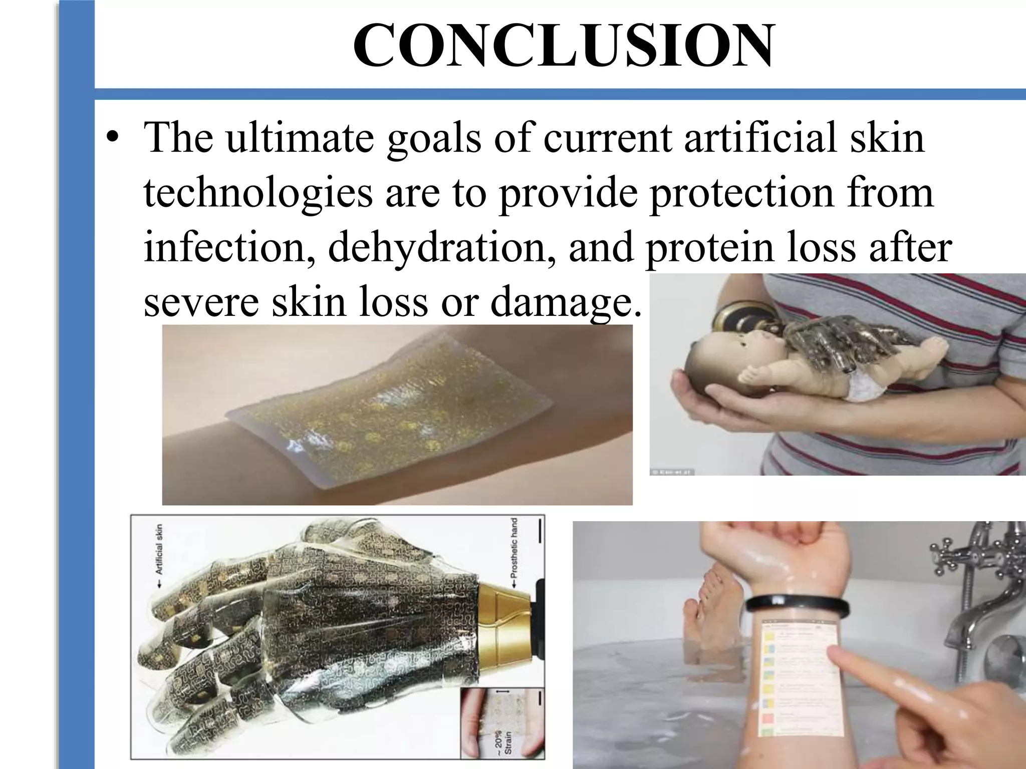 CONCLUSION
• The ultimate goals of current artificial skin
technologies are to provide protection from
infection, dehydration, and protein loss after
severe skin loss or damage.
 
