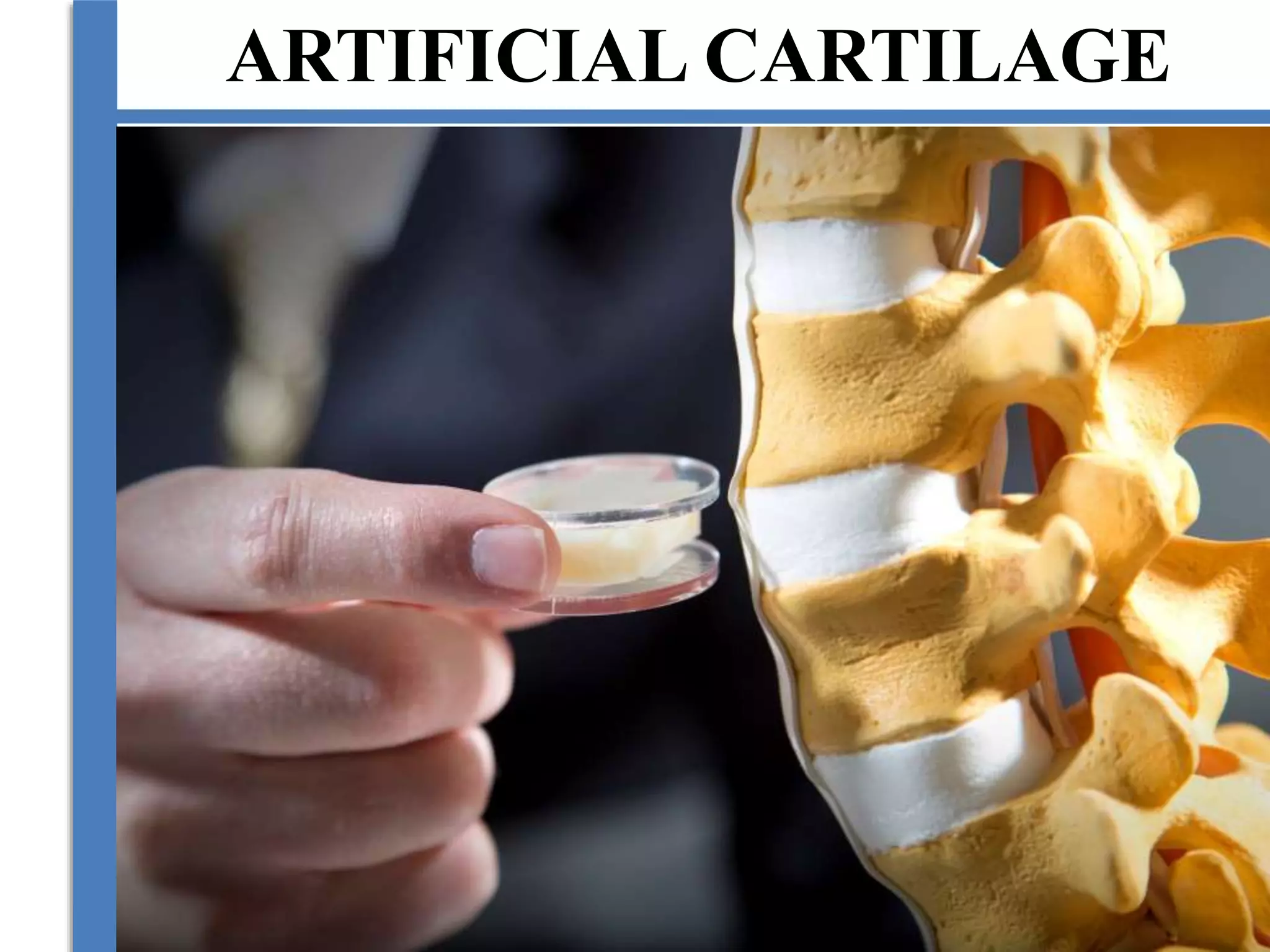 ARTIFICIAL CARTILAGE
 