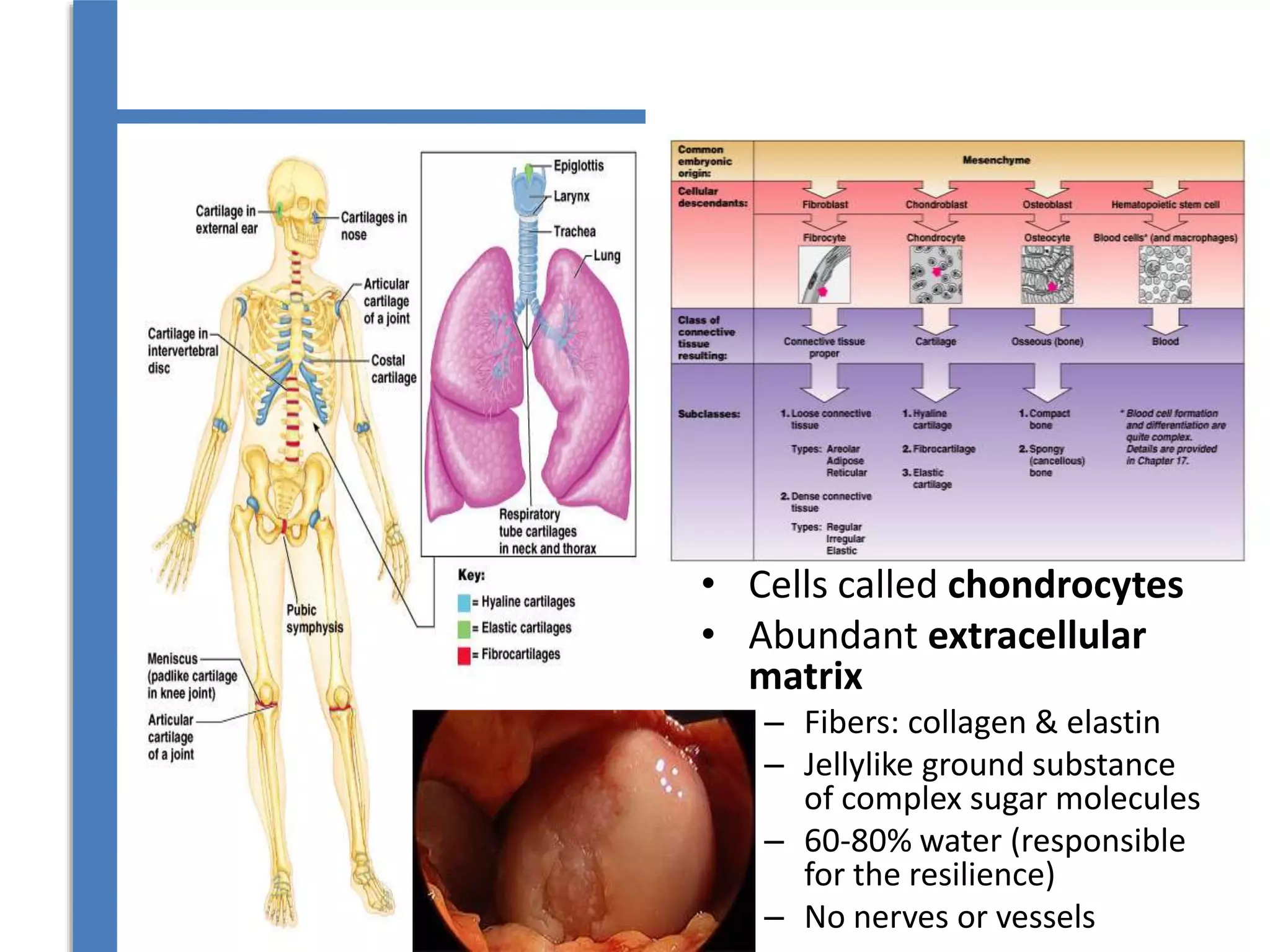 • Cells called chondrocytes
• Abundant extracellular
matrix
– Fibers: collagen & elastin
– Jellylike ground substance
of complex sugar molecules
– 60-80% water (responsible
for the resilience)
– No nerves or vessels
 