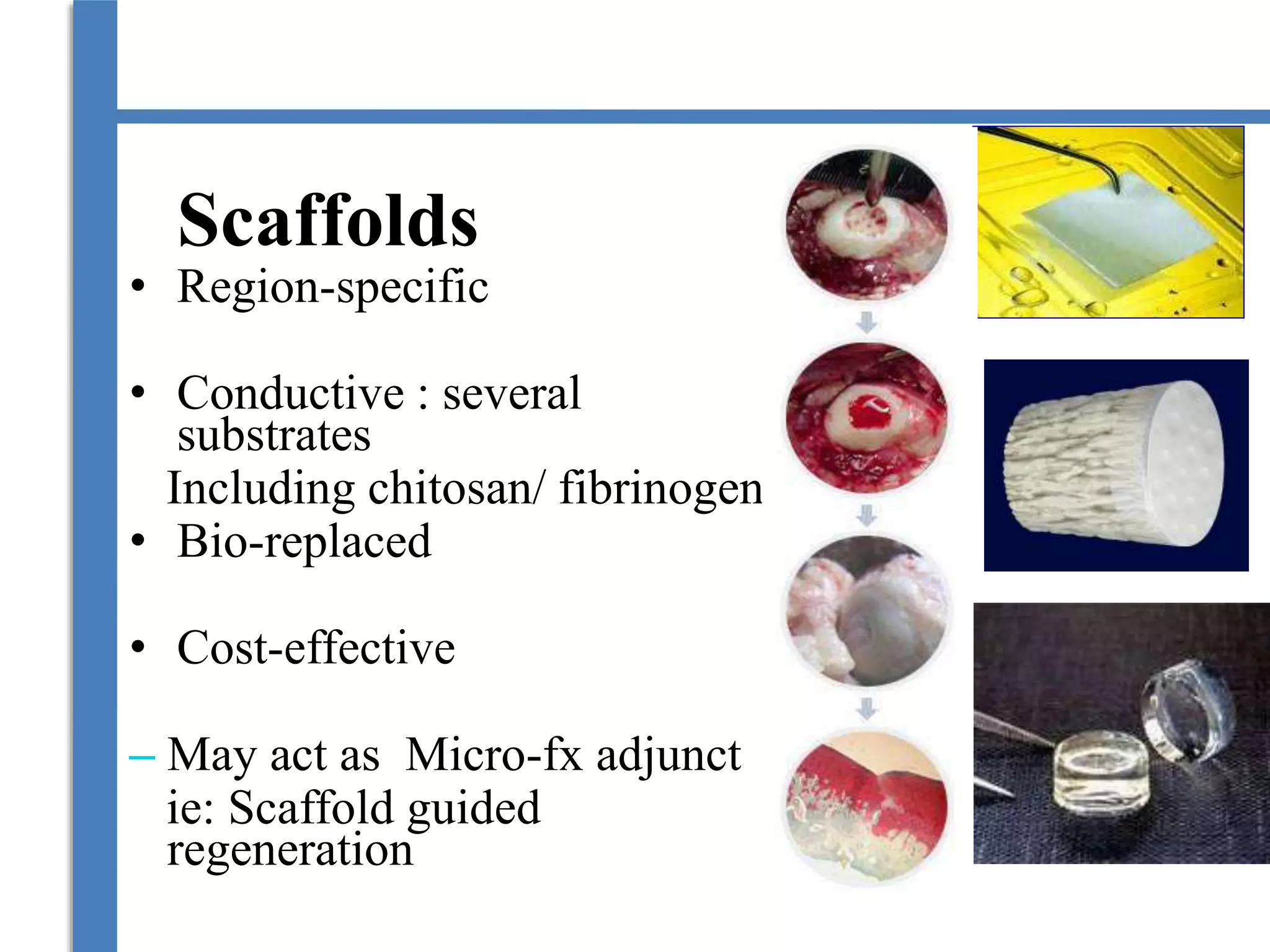 Scaffolds
• Region-specific
• Conductive : several
substrates
Including chitosan/ fibrinogen
• Bio-replaced
• Cost-effective
– May act as Micro-fx adjunct
ie: Scaffold guided
regeneration
 
