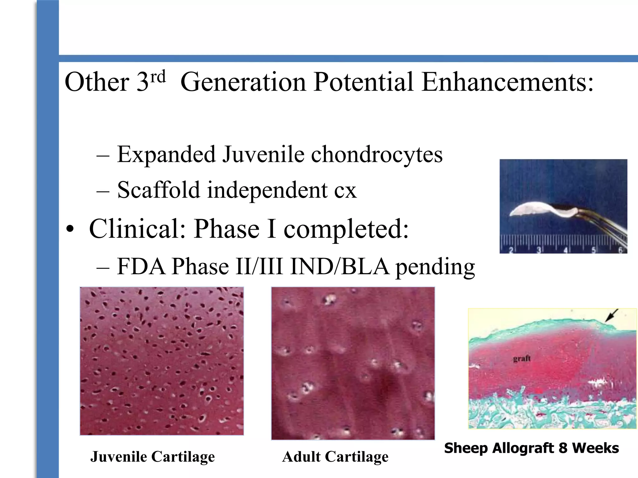 Other 3rd Generation Potential Enhancements:
– Expanded Juvenile chondrocytes
– Scaffold independent cx
• Clinical: Phase I completed:
– FDA Phase II/III IND/BLA pending
Sheep Allograft 8 Weeks
Juvenile Cartilage Adult Cartilage
 