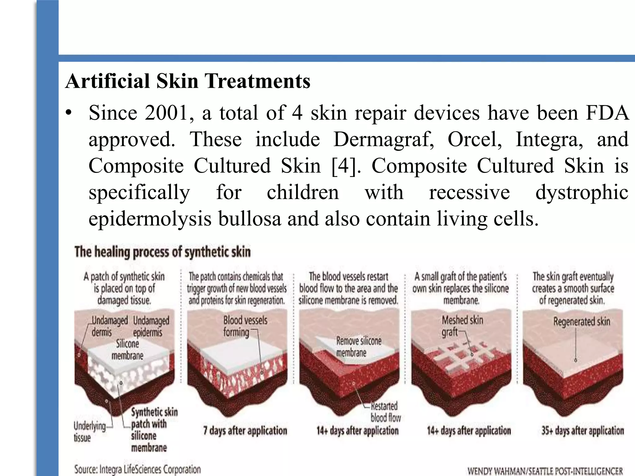 Artificial Skin Treatments
• Since 2001, a total of 4 skin repair devices have been FDA
approved. These include Dermagraf, Orcel, Integra, and
Composite Cultured Skin [4]. Composite Cultured Skin is
specifically for children with recessive dystrophic
epidermolysis bullosa and also contain living cells.
 