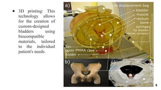 ARTIFICIAL URINARY BLADDER innovation.pptx