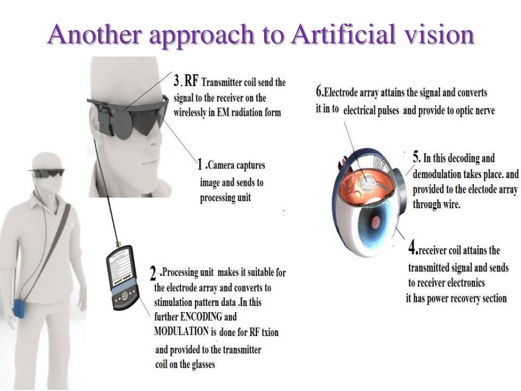 Artificial vision