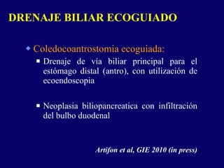 Coledocoantrostomia ecoguiada:  Drenaje de vía biliar principal para el estómago distal (antro), con utilización de ecoendoscopia Neoplasia biliopancreatica con infiltración del bulbo duodenal Artifon et al, GIE 2010 (in press) DRENAJE BILIAR ECOGUIADO 