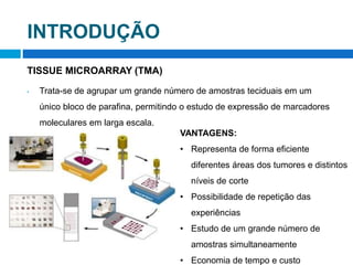 INTRODUÇÃO
TISSUE MICROARRAY (TMA)
• Trata-se de agrupar um grande número de amostras teciduais em um
único bloco de parafina, permitindo o estudo de expressão de marcadores
moleculares em larga escala.
VANTAGENS:
• Representa de forma eficiente
diferentes áreas dos tumores e distintos
níveis de corte
• Possibilidade de repetição das
experiências
• Estudo de um grande número de
amostras simultaneamente
• Economia de tempo e custo
 