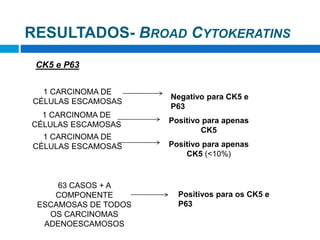 CK5 e P63
1 CARCINOMA DE
CÉLULAS ESCAMOSAS
Negativo para CK5 e
P63
Positivo para apenas
CK5 (<10%)
63 CASOS + A
COMPONENTE
ESCAMOSAS DE TODOS
OS CARCINOMAS
ADENOESCAMOSOS
Positivos para os CK5 e
P63
1 CARCINOMA DE
CÉLULAS ESCAMOSAS
RESULTADOS- BROAD CYTOKERATINS
1 CARCINOMA DE
CÉLULAS ESCAMOSAS
Positivo para apenas
CK5
 