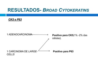 CK5 e P63
1 ADENOCARCINOMA
1 CARCINOMA DE LARGE-
CELLS
Positivo para CK5(1% -2% das
células).
Positivo para P63
RESULTADOS- BROAD CYTOKERATINS
 
