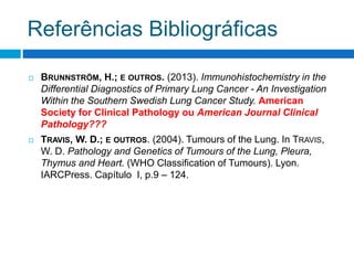 Referências Bibliográficas
 BRUNNSTRÖM, H.; E OUTROS. (2013). Immunohistochemistry in the
Differential Diagnostics of Primary Lung Cancer - An Investigation
Within the Southern Swedish Lung Cancer Study. American
Society for Clinical Pathology ou American Journal Clinical
Pathology???
 TRAVIS, W. D.; E OUTROS. (2004). Tumours of the Lung. In TRAVIS,
W. D. Pathology and Genetics of Tumours of the Lung, Pleura,
Thymus and Heart. (WHO Classification of Tumours). Lyon.
IARCPress. Capítulo I, p.9 – 124.
 