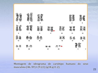 Montagem de ideograma de cariótipo humano do sexo
masculino (46, XY) t (9;22) (q34;q11.2).
21
 