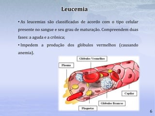 6
• As leucemias são classificadas de acordo com o tipo celular
presente no sangue e seu grau de maturação. Compreendem duas
fases: a aguda e a crônica;
• Impedem a produção dos glóbulos vermelhos (causando
anemia).
Leucemia
 