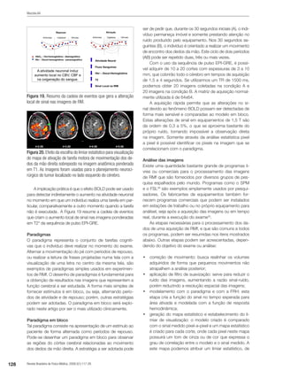 128 Revista Brasileira de Física Médica. 2009;3(1):117-29.
Mazzola AA
A implicação prática é que o efeito BOLD pode ser usado
para detectar indiretamente o aumento na atividade neuronal
no momento em que um indivíduo realiza uma tarefa em par-
ticular, comparativamente a outro momento quando a tarefa
não é executada . A Figura 19 resume a cadeia de eventos
que criam o aumento local de sinal nas imagens ponderadas
em T2* da sequência de pulso EPI-GRE.
Paradigmas
O paradigma representa o conjunto de tarefas cogniti-
vas que o indivíduo deve realizar no momento do exame.
Alternar a movimentação do pé com períodos de repouso,
ou realizar a leitura de frases projetadas numa tela com a
visualização de uma letra no centro da mesma tela, são
exemplos de paradigmas simples usados em experimen-
tos de RMf. O desenho de paradigmas é fundamental para
a obtenção de resultados nas imagens que representem a
função cerebral a ser estudada. A forma mais simples de
fornecer estímulos é em bloco, ou seja, alternando perío-
dos de atividade e de repouso; porém, outras estratégias
podem ser adotadas. O paradigma em bloco será explo-
rado neste artigo por ser o mais utilizado clinicamente.
Paradigma em bloco
Tal paradigma consiste na apresentação de um estímulo ao
paciente de forma alternada como períodos de repouso.
Pode-se desenhar um paradigma em bloco para observar
as regiões do córtex cerebral relacionadas ao movimento
dos dedos da mão direita. A estratégia a ser adotada pode
ser de pedir que, durante os 30 segundos iniciais (A), o indi-
víduo permaneça imóvel e somente prestando atenção no
ruído produzido pelo equipamento. Nos 30 segundos se-
guintes (B), o indivíduo é orientado a realizar um movimento
de encontro dos dedos da mão. Este ciclo de dois períodos
(AB) pode ser repetido duas, três ou mais vezes.
Com o uso da sequência de pulso EPI-GRE, é possí-
vel adquirir de 10 a 20 cortes com espessuras de 3 a 10
mm, que cobrirão todo o cérebro em tempos de aquisição
de 1,5 a 4 segundos. Se utilizarmos um TR de 1500 ms,
podemos obter 20 imagens coletadas na condição A e
20 imagens na condição B. A matriz de aquisição normal-
mente utilizada é de 64x64.
A aquisição rápida permite que as alterações no si-
nal devido ao fenômeno BOLD possam ser detectadas de
forma mais sensível e comparadas ao modelo em bloco.
Estas alterações de sinal em equipamentos de 1,5 T são
da ordem de 0,3 a 5%, o que se aproxima bastante do
próprio ruído, tornando impossível a observação direta
na imagem. Somente através da análise estatística pixel
a pixel é possível identificar os pixels na imagem que se
correlacionam com o paradigma.
Análise das imagens
Existe uma quantidade bastante grande de programas li-
vres ou comerciais para o processamento das imagens
de RMf que são fornecidos por diversos grupos de pes-
quisa espalhados pelo mundo. Programas como o SPM
e o FSL26
são exemplos amplamente usados por pesqui-
sadores. Os fabricantes de equipamentos também for-
necem programas comerciais que podem ser instalados
em estações de trabalho ou no próprio equipamento para
análisel, seja após a aquisição das imagens ou em tempo
real, durante a execução do exame25
.
As etapas necessárias para o processamento dos da-
dos de uma aquisição de RMf, e que são comuns a todos
os programas, podem ser resumidas nos itens mostrados
abaixo. Outras etapas podem ser acrescentadas, depen-
dendo do objetivo do exame ou análise:
•	 correção de movimento: busca realinhar os volumes
adquiridos de forma que pequenos movimentos não
atrapalhem a análise posterior;
•	 aplicação de filtro de suavização: serve para reduzir o
ruído das imagens, aumentando a razão sinal-ruído,
porém reduzindo a resolução espacial das imagens;
•	 modelamento com o paradigma e com a FRH: esta
etapa cria a função do sinal no tempo esperada para
área ativada e modelada com a função de resposta
hemodinâmica;
•	 geração do mapa estatístico e estabelecimento do li-
miar de visualização: o modelo criado é comparado
com o sinal medido pixel-a-pixel e um mapa estatístico
é criado para cada corte, onde cada pixel neste mapa
possuirá um tom de cinza ou de cor que expressa o
grau de correlação entre o modelo e o sinal medido. A
este mapa podemos atribuir um limiar estatístico, de
Figura 19. Resumo da cadeia de eventos que gera a alteração
local de sinal nas imagens de RM.
Figura 20. Efeito da escolha do limiar estatístico para visualização
do mapa de ativação de tarefa motora de movimentação dos de-
dos da mão direita sobreposto na imagem anatômica ponderada
em T1. As imagens foram usadas para o planejamento neuroci-
rúrgico do tumor localizado no lado esquerdo do cérebro.
 