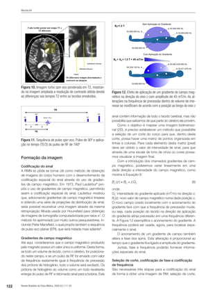 122 Revista Brasileira de Física Médica. 2009;3(1):117-29.
Mazzola AA
Formação da imagem
Codificação do sinal
A RMN só pôde se tornar útil como método de obtenção
de imagens do corpo humano com o desenvolvimento da
codificação espacial do sinal através do uso de gradien-
tes de campo magnético. Em 1973, Paul Lauterbur6
pro-
pôs o uso de gradientes de campo magnético, permitindo
assim a codificação espacial do sinal. Lauterbur mostrou
que, adicionando gradientes de campo magnético lineares
e obtendo uma série de projeções da distribuição de sinal,
seria possível reconstruir uma imagem através da mesma
retroprojeção filtrada usada por Hounsfield para obtenção
de imagens de tomografia computadorizada por raios-x7
. O
método foi aprimorado por muito outros pesquisadores, in-
cluindo Peter Mansfield, o qual propôs também a sequência
de pulso eco planar (EPI), que será tratada mais adiante8
.
Gradientes de campo magnético
Até aqui, consideramos que o campo magnético produzido
pelo magneto possui um valor único e uniforme. Desta forma,
se todo um volume de tecido, como o cérebro, for posiciona-
do neste campo, e se um pulso de RF for enviado com valor
de frequência exatamente igual à frequência de precessão
dos prótons de hidrogênio, todo o volume será excitado. Os
prótons de hidrogênio do volume como um todo receberão
energia do pulso de RF e retornarão sinal para a bobina. Este
sinal contém informação de todo o tecido cerebral, mas não
possibilita que saibamos de que parte do cérebro ele provém.
Como o objetivo é mapear uma imagem bidimensio-
nal (2D), é preciso estabelecer um método que possibilite
a seleção de um corte do corpo para que, dentro deste
corte, possa haver uma matriz de pontos organizada em
linhas e colunas. Para cada elemento desta matriz (pixel)
deve ser obtido o valor de intensidade de sinal, para que
através de uma escala de tons de cinza ou cores possa-
mos visualizar a imagem final.
Com a introdução dos chamados gradientes de cam-
po magnético, poderemos variar linearmente em uma
dada direção a intensidade do campo magnético, como
mostra a Equação 6:
 (6)
onde:
Gz
: intensidade do gradiente aplicado (mT/m) na direção z;
Bz
(z): novo valor de campo magnético numa dada posição z.
O novo campo criado localmente com o acionamento do
gradiente fará com que a frequência de precessão mude,
ou seja, cada posição do tecido na direção de aplicação
do gradiente atinja precessão em uma frequência diferen-
te. A Figura 12 exemplifica o acionamento do gradiente. A
frequência poderá ser usada, agora, para localizar espa-
cialmente o sinal.
O acionamento de um gradiente de campo também
altera a fase dos spins. Esta alteração é proporcional ao
tempo que o gradiente fica ligado e amplitude do gradiente.
Juntas, fase e frequência poderão fornecer informa-
ções espaciais do sinal.
Seleção de corte, codificação de fase e codificação
de frequência
São necessárias três etapas para a codificação do sinal
de forma a obter uma imagem de RM: seleção de corte,
Figura 11. Sequência de pulso spin eco. Pulso de 90º e aplica-
ção no tempo (TE/2) do pulso de RF de 180º
Figura 10. Imagem turbo spin eco ponderada em T2, mostran-
do na imagem ampliada a resolução de contraste obtida devido
as diferenças nos tempos T2 entre os tecidos envolvidos.
Figura 12. Efeito de aplicação de um gradiente de campo mag-
nético na direção do eixo z com amplitude de 45 mT/m. As al-
terações na frequência de precessão dentro do volume de inte-
resse se modificam de acordo com a posição ao longo do eixo z
 
