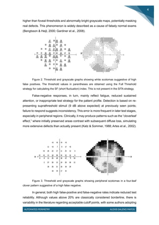 Cloverleaf Pattern Field Defect Comprehensive Overview of Automated Perimetry in Visual Field ...