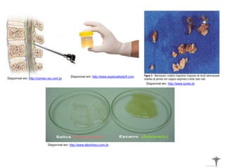 Disponível em: http://correio.rac.com.br
Disponível em: http://www.especialista24.com
Disponível em: http://www.scielo.br
Disponível em: http://www.labclinisul.com.br
 