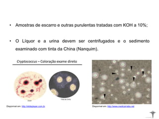 • Amostras de escarro e outras purulentas tratadas com KOH a 10%;
• O Líquor e a urina devem ser centrifugados e o sedimento
examinado com tinta da China (Nanquim).
Disponível em: http://slideplayer.com.br Disponível em: http://www.medical-labs.net
 