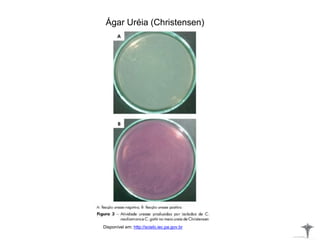 Ágar Uréia (Christensen)
Disponível em: http://scielo.iec.pa.gov.br
 