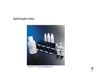 Disponível em: http://www.casalab.com.br
Aglutinação Látex
 