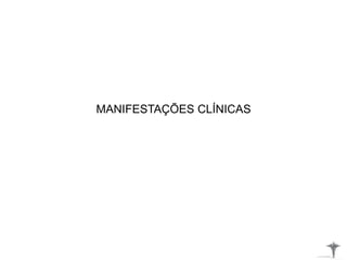 MANIFESTAÇÕES CLÍNICAS
 
