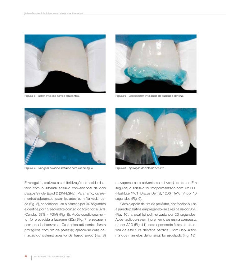 Artigo dental press 2010