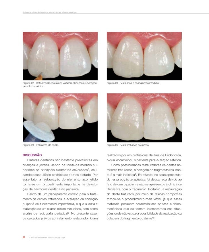Artigo dental press 2010