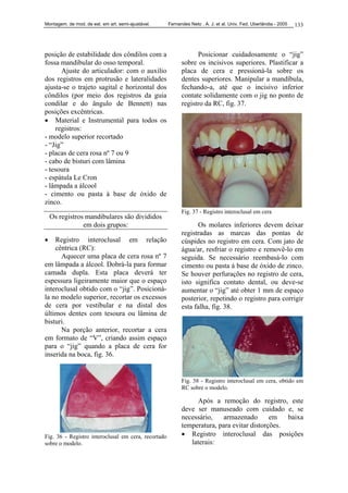 Montagem. de mod. de est. em art. semi-ajustável. Fernandes Neto , A. J. et al. Univ. Fed. Uberlândia - 2005 133
posição de estabilidade dos côndilos com a
fossa mandibular do osso temporal.
Ajuste do articulador: com o auxílio
dos registros em protrusão e lateralidades
ajusta-se o trajeto sagital e horizontal dos
côndilos (por meio dos registros da guia
condilar e do ângulo de Bennett) nas
posições excêntricas.
• Material e Instrumental para todos os
registros:
- modelo superior recortado
- “Jig”
- placas de cera rosa nº 7 ou 9
- cabo de bisturi com lâmina
- tesoura
- espátula Le Cron
- lâmpada a álcool
- cimento ou pasta à base de óxido de
zinco.
Os registros mandibulares são divididos
em dois grupos:
• Registro interoclusal em relação
cêntrica (RC):
Aquecer uma placa de cera rosa nº 7
em lâmpada a álcool. Dobrá-la para formar
camada dupla. Esta placa deverá ter
espessura ligeiramente maior que o espaço
interoclusal obtido com o “jig”. Posicioná-
la no modelo superior, recortar os excessos
de cera por vestibular e na distal dos
últimos dentes com tesoura ou lâmina de
bisturi.
Na porção anterior, recortar a cera
em formato de “V”, criando assim espaço
para o “jig” quando a placa de cera for
inserida na boca, fig. 36.
Fig. 36 - Registro interoclusal em cera, recortado
sobre o modelo.
Posicionar cuidadosamente o “jig”
sobre os incisivos superiores. Plastificar a
placa de cera e pressioná-la sobre os
dentes superiores. Manipular a mandíbula,
fechando-a, até que o incisivo inferior
contate solidamente com o jig no ponto de
registro da RC, fig. 37.
Fig. 37 - Registro interoclusal em cera
Os molares inferiores devem deixar
registradas as marcas das pontas de
cúspides no registro em cera. Com jato de
água/ar, resfriar o registro e removê-lo em
seguida. Se necessário reembasá-lo com
cimento ou pasta á base de óxido de zinco.
Se houver perfurações no registro de cera,
isto significa contato dental, ou deve-se
aumentar o “jig” até obter 1 mm de espaço
posterior, repetindo o registro para corrigir
esta falha, fig. 38.
Fig. 38 - Registro interoclusal em cera, obtido em
RC sobre o modelo.
Após a remoção do registro, este
deve ser manuseado com cuidado e, se
necessário, armazenado em baixa
temperatura, para evitar distorções.
• Registro interoclusal das posições
laterais:
 