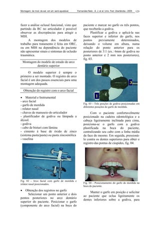 Montagem. de mod. de est. em art. semi-ajustável. Fernandes Neto , A. J. et al. Univ. Fed. Uberlândia - 2005 125
fazer a análise oclusal funcional, visto que
partindo da RC no articulador é possível
observar as discrepâncias para atingir a
MIH.
A montagem dos modelos de
trabalho para tratamento é feita em ORC,
ou em MIH na dependência do paciente
não apresentar sinais e sintomas de oclusão
traumática.
Montagem do modelo de estudo do arco
dentário superior
O modelo superior é sempre o
primeiro a ser montado. O registro do arco
facial é um dos passos essenciais para uma
montagem adequada.
Obtenção do registro com o arco facial
• Material e Instrumental
- arco facial
- garfo de mordida
- relator nasal
- chaves de manuseio do articulador
- plastificador de godiva ou lâmpada a
álcool.
- godiva
- cabo de bisturi com lâmina
- cimento à base de óxido de zinco
(sistema pasta/pasta) ou pasta zincoenólica
- vaselina
Fig. 02 - Arco facial com garfo de mordida e
relator nasal posicionados.
• Obtenção dos registros no garfo
Selecionar um ponto anterior e dois
pontos posteriores no arco dentário
superior do paciente. Posicionar o garfo
(componente do arco facial) na boca do
paciente e marcar no garfo os três pontos,
que receberão a godiva.
Plastificar a godiva e aplicá-la nas
faces superior e inferior do garfo, nos
pontos previamente determinados,
deixando o volume em altura, numa
relação do ponto anterior para os
posteriores de 3:1 (ex.: 6mm de godiva no
ponto anterior e 2 mm nos posteriores),
fig. 03.
Fig. 03 - Três porções de godiva posicionadas em
diferentes posições do garfo de mordida.
Com o paciente confortavelmente
posicionado na cadeira odontológica e a
cabeça ligeiramente inclinada para cima,
posiciona-se o garfo com a godiva
plastificada na boca do paciente,
centralizando seu cabo com a linha média
da face do mesmo. Em seguida, pressioná-
lo contra os dentes superiores para obter o
registro das pontas de cúspides, fig. 04.
Fig. 04 - Posicionamento do garfo de mordida na
boca do paciente.
Manter o garfo em posição e solicitar
ao paciente que oclua ligeiramente os
dentes inferiores sobre a godiva, para
 