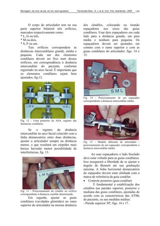 Montagem. de mod. de est. em art. semi-ajustável. Fernandes Neto , A. J. et al. Univ. Fed. Uberlândia - 2005 128
O corpo do articulador tem na sua
parte superior bilateral três orifícios,
marcados respectivamente como:
* L, G ou três.
* M ou dois.
* S, P ou um.
Tais orifícios correspondem às
distâncias intercondilares grande, média e
pequena. Cada um dos elementos
condilares deverá ser fixo num desses
orifícios, em correspondência à distância
intercondilar do paciente, conforme
registrado no arco facial. É importante que
os elementos condilares sejam bem
ajustados, fig.12.
Fig. 12 - Vista posterior do ASA, registro das
distancias condilares.
Se o registro da distância
intercondilar no arco facial coincidir com a
linha demarcatória entre duas distâncias,
ajustar o articulador sempre na distância
menor, o que resultará em cúspides mais
baixas havendo menor possibilidade de
interferências, fig. 13.
Fig. 13 - Posicionamento do côndilo no orifício
correspondente à distancia condilar determinada.
Em seguida, ajustar as guias
condilares (cavidades glenóides) no ramo
superior do articulador na mesma distância
dos côndilos, colocando ou tirando
espaçadores nos eixos das guias
condilares. Usar dois espaçadores em cada
lado para a distância grande, um para
média e nenhum para pequena. Os
espaçadores devem ser ajustados em
contato com o ramo superior e com as
guias condilares do articulador, figs. 14 e
15.
Fig. 14 - Posicionamento de um espaçador
correspondente a distancia intercondilar média.
Fig. 15 - Modelo diferente de articulador -
posicionamento de um espaçador correspondente a
distancia intercondilar média.
Ao usar espaçadores o lado biselado
deve estar voltado para as guias condilares.
Isso assegurará a liberdade de se ajustar o
ângulo de Bennett até sua graduação
máxima. A linha horizontal demarcatória
do espaçador deverá estar alinhada com a
marca de referência da guia condilar.
• Controle posterior (guia condilar)
É fundamental a estabilização dos
côndilos nas paredes superior, posterior e
mediana das guias condilares, ajustadas de
acordo com as características das ATMs
do paciente, ou nas medidas médias:
- Parede superior 30º, figs. 16 e 17.
 