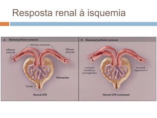 Resposta renal à isquemia
 