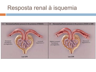 Resposta renal à isquemia
 