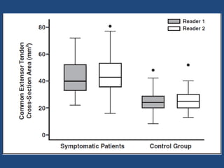 Artigo epicondilite lateral