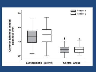 Artigo epicondilite lateral