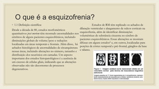 O que é a esquizofrenia?
◦ 1.1 Definição científica:
Desde a década de 80, estudos morfométricos
quantitativos post mortem têm mostrado anormalidades nos
cérebros de alguns pacientes esquizofrênicos, incluindo
diminuições globais de volume/peso e reduções
localizadas em áreas temporais e frontais. Além disso, há
achados histológicos de anormalidades de citoarquitetura
nessas áreas, incluindo alterações no número, tamanho e
distribuição dos neurônios em camadas. Um aspecto
importante dos estudos histopatológicos é a ausência de
um excesso de células gliais, indicando que as alterações
observadas não são decorrentes de processos
degenerativos.
Estudos de RM têm replicado os achados de
dilatação ventricular e alargamento de sulcos corticais na
esquizofrenia, além de identificar diminuições
volumétricas de substância cinzenta no cérebro de
pacientes esquizofrênicos. Essas alterações se mostram
difusas em alguns estudos6 e, em outros, localizadas para
porções de córtex temporal e pré-frontal, gânglios da base
e tálamo.
 