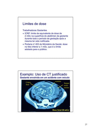 27
Limites de dose
Trabalhadoras Gestantes
ICRP: limite de equivalente de dose de
2 mSv na superfície do abdômen da gestante
durante todo o período de gestação após a
mesma ter sido notificada.
Portaria no 453 do Ministério da Saúde: dose
no feto inferior a 1 mSv, que é o limite
adotado para o público.
Examplo: Uso de CT justificado
Gestante envolvida em um acidente com veículo
Crânio
fetal
costelas
Sangue
extra-
uterino
Dose fetal 20 mGy
 