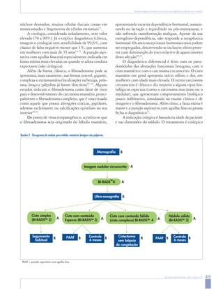 215
Rev Bras Ginecol Obstet. 2007; 29(4):211-9
Nódulos benignos da mama: uma revisão dos diagnósticos diferenciais e conduta
núcleos desnudos, muitas células ductais coesas em
monocamadas e fragmentos de células estromais11
.
A citologia, considerada isoladamente, tem valor
elevado (70 a 90%). Já o tríplice diagnóstico (clínica,
imagem e citologia) tem sensibilidade de 99,6%, com
chance de falso negativo menor que 1%, que aumenta
em mulheres com mais de 35 anos14,15
. A punção aspi-
rativa com agulha fina está especialmente indicada em
faixas etárias mais elevadas ou quando se adota conduta
expectante (não cirúrgica).
Além da forma clássica, o fibroadenoma pode se
apresentar, mais raramente, nas formas juvenil, gigante,
complexa e extramamária (localizações na bexiga, prós-
tata, braço e pálpebra já foram descritos)16-19
. Alguns
estudos indicam o fibroadenoma como fator de risco
para o desenvolvimento do carcinoma mamário, princi-
palmente o fibroadenoma complexo, que é conceituado
como aquele que possui alterações císticas, papilares,
adenose esclerosante ou calcificações epiteliais no seu
interior20,21
.
Do ponto de vista etiopatogênico, acredita-se que
o fibroadenoma seja originado do lóbulo mamário,
apresentando estreita dependência hormonal, aumen-
tando na lactação e regredindo na pós-menopausa, e
não sofrendo transformação maligna. Apesar da sua
estrogênio-dependência, não responde a terapêutica
hormonal. Os anticoncepcionais hormonais orais podem
ser empregados, descrevendo-se inclusive efeito prote-
tor com diminuição do risco relativo de aparecimento
desta afecção10,22
.
O diagnóstico diferencial é feito com os pseu-
donódulos das alterações funcionais benignas, com o
cisto mamário e com o carcinoma circunscrito. O cisto
mamário em geral apresenta início súbito e dor, em
mulheres com idade mais elevada. O termo carcinoma
circunscrito é clínico e diz respeito a alguns tipos his-
tológicos especiais (como o carcinoma mucinoso ou o
medular), que apresentam comportamento biológico
pouco infiltrativo, simulando no exame clínico e de
imagem e o fibroadenoma. Além disto, a faixa etária é
maior e a punção aspirativa com agulha fina ou grossa
fecha o diagnóstico23
.
A indicação cirúrgica é baseada na idade da paciente
e nas dimensões do nódulo. O tratamento é cirúrgico
Mamografia B
A
B
A
Ultra-sonografia
Seguimento
habitual
B PAAF B Controle
6 meses
B PAAF B
A
A
A
Controle
6 meses
Imagem nodular circunscrita
BI-RADS
TM
0
A
B
Cisto simples
(BI-RADSTM
2)
Cisto com conteúdo
Espesso (BI-RADSTM
3)
Cisto com conteúdo Sólido
(cisto complexo) BI-RADSTM
4
Nódulo sólido
(BI-RADSTM
3)
Cistectomia
sem biópsia
de congelação
B
Quadro 2 - Fluxograma de conduta para nódulos mamários benignos não palpáveis.
PAAF = punção aspirativa com agulha fina
 