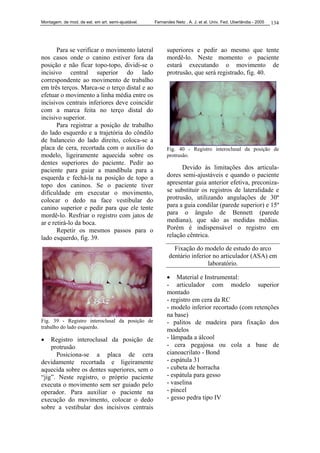 Montagem. de mod. de est. em art. semi-ajustável. Fernandes Neto , A. J. et al. Univ. Fed. Uberlândia - 2005 134
Para se verificar o movimento lateral
nos casos onde o canino estiver fora da
posição e não ficar topo-topo, dividi-se o
incisivo central superior do lado
correspondente ao movimento de trabalho
em três terços. Marca-se o terço distal e ao
efetuar o movimento a linha média entre os
incisivos centrais inferiores deve coincidir
com a marca feita no terço distal do
incisivo superior.
Para registrar a posição de trabalho
do lado esquerdo e a trajetória do côndilo
de balanceio do lado direito, coloca-se a
placa de cera, recortada com o auxílio do
modelo, ligeiramente aquecida sobre os
dentes superiores do paciente. Pedir ao
paciente para guiar a mandíbula para a
esquerda e fechá-la na posição de topo a
topo dos caninos. Se o paciente tiver
dificuldade em executar o movimento,
colocar o dedo na face vestibular do
canino superior e pedir para que ele tente
mordê-lo. Resfriar o registro com jatos de
ar e retirá-lo da boca.
Repetir os mesmos passos para o
lado esquerdo, fig. 39.
Fig. 39 - Registro interoclusal da posição de
trabalho do lado esquerdo.
• Registro interoclusal da posição de
protrusão
Posiciona-se a placa de cera
devidamente recortada e ligeiramente
aquecida sobre os dentes superiores, sem o
“jig”. Neste registro, o próprio paciente
executa o movimento sem ser guiado pelo
operador. Para auxiliar o paciente na
execução do movimento, colocar o dedo
sobre a vestibular dos incisivos centrais
superiores e pedir ao mesmo que tente
mordê-lo. Neste momento o paciente
estará executando o movimento de
protrusão, que será registrado, fig. 40.
Fig. 40 - Registro interoclusal da posição de
protrusão.
Devido às limitações dos articula-
dores semi-ajustáveis e quando o paciente
apresentar guia anterior efetiva, preconiza-
se substituir os registros de lateralidade e
protrusão, utilizando angulações de 30º
para a guia condilar (parede superior) e 15º
para o ângulo de Bennett (parede
mediana), que são as medidas médias.
Porém é indispensável o registro em
relação cêntrica.
Fixação do modelo de estudo do arco
dentário inferior no articulador (ASA) em
laboratório.
• Material e Instrumental:
- articulador com modelo superior
montado
- registro em cera da RC
- modelo inferior recortado (com retenções
na base)
- palitos de madeira para fixação dos
modelos
- lâmpada a álcool
- cera pegajosa ou cola a base de
cianoacrilato - Bond
- espátula 31
- cubeta de borracha
- espátula para gesso
- vaselina
- pincel
- gesso pedra tipo IV
 