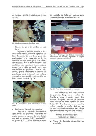 Montagem. de mod. de est. em art. semi-ajustável. Fernandes Neto , A. J. et al. Univ. Fed. Uberlândia - 2005 127
do paciente e apertar o parafuso que o fixa,
fig. 08.
Fig. 08 - Posicionamento do relator nasal.
• Fixação do garfo de mordida ao arco
facial
Enquanto o paciente mantém o arco
facial com firmeza, deslocar a presilha da
haste horizontal do arco facial para trás,
deslizando-a pelo cabo do garfo de
mordida, até que fique perto dos lábios,
sem tocá-los. Use a mão esquerda para
estabilizar todo o conjunto durante o ajuste
para evitar o efeito de torção que causa
desconforto ao paciente. Com a mão
direita, apertar firmemente o parafuso da
presilha da haste horizontal com a chave
adequada e, em seguida, o da presilha na
barra vertical do arco, fig. 09.
Fig. 09 - Fixação do garfo de mordida ao arco
facial
• Registro da distância intercondilar
Observar a distância intercondilar
aproximada do paciente, registrada na
região anterior e superior do arco facial,
que pode ser pequena (P/S/1), média (M/2)
ou grande (G/L/3). Esta informação deve
ser anotada na ficha do paciente para
posterior ajuste do articulador, fig. 10.
Fig. 10 - Observação da distância intercondilar
aproximada do paciente, registrada na região
anterior e superior do arco facial.
Fig. 11 - Arco facial posicionado no paciente.
Para remoção do arco facial da face
do paciente, desapertar o parafuso de
fixação e retirar o relator nasal. Em
seguida, desaperte somente o parafuso
mais anterior da parte superior do arco
facial. Os dois laterais, se afrouxados,
podem bascular o garfo. Solicitar ao
paciente que abra lentamente a boca e logo
após retirar todo o conjunto com cuidado.
Preparo do articulador para
Montagem dos modelos
• Ajustar da distância intercondilar no
articulador
 