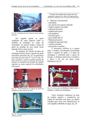 Montagem. de mod. de est. em art. semi-ajustável. Fernandes Neto , A. J. et al. Univ. Fed. Uberlândia - 2005 130
Fig. 22 - Instalação do arco facial no ramo superior
do ASA.
Em seguida apoiar as guias
condilares do ramo superior sobre os
côndilos já instalados no corpo do
articulador. Ao mesmo tempo, a haste do
garfo de mordida do arco facial ficará
apoiada sobre a mesa incisal.
No parafuso de fixação da placa de
montagem inferior fixar o suporte do garfo
(acessório opcional), fig. 23, ou posicionar
um rolete de cera rosa nº 7 ou nº 9, fig. 24,
para sustentar o garfo evitando báscula do
mesmo no momento da fixação do modelo
superior ao ramo superior do articulador,
com gesso.
Fig. 23 - Posicionamento do suporte do garfo de
mordida no ramo inferior do ASA.
Fig. 24 - Posicionamento do rolete de cera no ramo
inferior do ASA.
Fixação do modelo de estudo do arco
dentário superior no ASA em laboratório.
• Material e Instrumental
- articulador
- arco facial com registro efetuado
- modelo superior recortado
- cubeta de borracha
- espátula para gesso
- cera pegajosa
- faca para gesso
- gesso pedra tipo IV
- balança para gesso
- medida de água (proveta)
- vaselina em pasta
- pincel para a vaselina.
É necessário verificar se o espaço
entre o modelo, devidamente posicionado
sobre o registro do garfo, e a placa de
montagem é suficiente para o gesso de
fixação. A distância ideal entre o modelo e
a placa é de um cm (para evitar
distorções), fig. 25.
Fig. 25- observação da distância ideal entre o
modelo e a placa de montagem.
Fazer retenções (ranhuras) na base
do modelo superior e umedecê-lo em
cubeta de borracha com água, (os dentes
voltados para cima sem umedecê-los) ou
com algodão embebido em água, fig. 26.
 