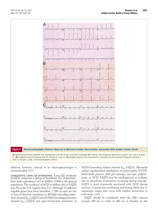 Artigo morte súbita