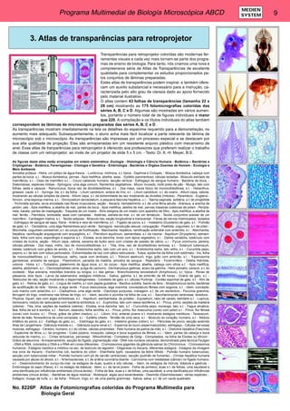 Programa Multimedial de Biología Microscópica ABCD 9 MEDIEN 
SYSTEM 
3. Atlas de transparências para retroprojetor 
Transparências para retroprojetor coloridas são modernas fer-ramentas 
visuais e cada vez mais tornam-se parte dos progra-mas 
de ensino de biologia. Para tanto, nós criamos uma nova e 
compreensiva série de Atlas de Transparências de excelente 
qualidade para complementar os estudos proporcionados pe-los 
conjuntos de lâminas preparadas. 
Estes atlas de transparências podem inspirar, e também ofere-cem 
um auxilio substancial e necessário para a instrução, ca-racterizada 
pelo alto grau de clareza dado ao apoio fornecido 
pelo material ilustrativo. 
O atlas contem 43 folhas de transparências (tamanho 22 x 
28 cm) mostrando as 175 fotomicrografias coloridas das 
séries A, B, C e D. Algumas são mostradas em vários aumen-tos, 
portanto o número total de de figuras individuais é maior 
que 220. A compilação e os títulos individuais do atlas também 
correspondem às lâminas de microscópio preparadas das séries A, B, C e D . 
As transparências mostram imediatamente na tela os detalhes do especime requerido para a demonstração, no 
aumento mais adequado. Subsequentemente, o aluno acha mais fácil localizar a parte relevante da lâmina de 
microscópio sob o microscópio. As transparências são impressas por um processo especial e se destacam por 
sua alta qualidade de projeção. Elas são armazenadas em um resistente arquivo plástico com mecanismo de 
anel. Esse atlas de tranparências para retroprojetor é oferecido aos professores que preferem realizar o trabalho 
de classe com um retroprojetor, ao invés de um projetor de slide 5 x 5 cm. - Texto: Dr. K.-H. Meyer, B.S. 
As figuras deste atlas estão arranjadas em ordem sistemática: Zoologia - Histologia e Ciência Humana - Botânica – Bactérias e 
Criptógamas - Botânica, Fanerógamas - Citologia e Genética - Embriologia - Bactérias e Órgãos Doentes de Homem - Ecologia e 
Meio Ambiente 
Amoeba proteus - Hidra, um pólipo de água fresca. - Lumbricus, minhoca, s.t. típica - Daphnia e Ciclopes. - Mosca doméstica, cabeça com 
partes da boca, u.i. - Mosca doméstica, pernas - Apis mellifica, abelha, asas. - Epitélio pavimentoso, células isoladas - Músculo estriado de 
mamíferos, s.l. - Osso de mamífero s.t., - Couro cabeludo humano, secção vertical - Esfregaço de sangue humano - Bactéria da boca, - 
Diatomácea, espécies mistas - Spirogyra, uma alga comum, filamentos vegetativos - Mucor mucedo, mofo preto de pão - Musgo, talo com 
folhas, seda e cápsula - Ranunculus, típica raiz de dicotideledônea, s.t. - Zea mays, caule típico de monocotiledônea, s.t. - Helianthus, 
girassol, caule, s t. - Syringa, lila, s.t. da folha. - Lilium candidum, antera de lírio, s.t. - Lilium candidum, s.t. de ovário - Allium cepa, cebola, 
mostrando as células simples da planta - Allium cepa, s.l. da extremidade da raiz mostrando as divisões (mitosis) - Paramécio - Euglena - 
Sincon, uma esponja marina, s.t. - Dicrocoelium lanceolatum, a pequena fascíola hepática, u.i. - Taenia saginata, solitária, s.t. de proglótide 
- Trichinella spiralis, larva encistada nas fibras musculares, seção - Ascaris, nematelminto, s.t. de uma fêma adulta - Araneus, a aranha de 
jardim, pés - Apis mellifera, a abelha de mel, partes da boca - Apis mellifica, abelha de mel, pernas traseiras coletoras de pólen - Peripla-neta, 
barata, partes de mastigação - Traquéia de um inseto - Átrio estigma de um inseto com aparelho de filtro - Apis mellifica, a abelha de 
mel, ferrão - Pierídeos, borboleta, asas com camadas - Astérias, estrela-do-mar, s.t. de um tentáculo - Tecido conjuntivo areolar de um 
mamífero - Cartilagem hialina, s.t. - Tecido adiposo - Músculo liso, seção longitudinal e transversal - Fibras de nervos mielinizados, isolados 
- Esfregaço de sangue de sapo, Rana - Artéria e veia de mamíferos, s.t. - Fígado de porco, s.t. - Instestino (Duodeno) de gato, s.t. - Pulmão 
de gato, s.t. - Oscilatória, uma alga filamentosa azul-verde - Spirogyra, reprodução sexual, conjugação - Psalliota, cogumelo, s.t. de píleo - 
Morchella, cogumelo comestível, s.t. do corpo de frutificação - Marchantia, hepática, ramificação anteridial com anteridio, s.l. - Marchantia, 
hepática, ramificação arquegonial com arquegônio, s.l. - Pteridium aquilinum, samambaia, s.t. da risoma - Aspidium (Dryopteris), samam-baia, 
folha com soro, esporângio e esporos s.t. - Elodea, erva daninha, broto com ápice vegetativo, s.l. - Dahlia variabilis, tubérculo com 
cristais de inulina, seção - Allium cepa, cebola, escama de bulbo seco com cristais de oxalato de cálcio, u.i. - Pyrus communis, pereira, 
células pétreas - Zea mays, milho, raiz de monocotiledônea, s.t. - Tilia, lima, raiz de dicolitedôneo lenhosa, s.t. - Solanum tuberosum, 
batata, tubérculo com grãos de amido, s.t. - Aristolochia sipho, talo com um ano, s.t. - Aristolochia sipho, talo velho, s.t. - Cucurbita pepo, 
pepino, s.l. de talo com tubos perfurados - Extremidades da raiz com pêlos radiculares - Tulipa, epiderme da folha com estômato - Iris, folha 
de monocotiledônea, s.t. - Sambucus, velho, caule com lenticela, s.t. - Triticum aestivum, trigo, grão com embrião, s.l. - Tripanosoma 
gambiense, amostra de sangue - Plasmodium, parasita da malária, amostra de sangue - Radiolário - Foraminífero - Obélia Hidróide, 
colonia - Hidra, s.t. - Turbelário, platelminto de água doce, s.t. do corpo - Apis mellifica, abelha, cabeça com olhos s.t. - Apis mellifica, 
abelha, abdomem, s.t. - Ctenocephalides canis, pulga de cachorro - Dermanyssus gallinae, ácaro da galinha - Helix pomatio, caracol, s.t. do 
ovoteste - Mya arenaria, mexiliões brandos ou longos, s.t. das gelras - Branchiostoma lanceolatum (Amphioxus), s.t. típica - Penas de 
pássaros, dois tipos - Larva da salamandra, estágios mitóticos - Gallus, galinha, s.t. de embrião de 48 horas - Ovário de gato, s.t. - 
Testículos de rato, seção mostrando o espermatogeneses - Cerebelo de gato, s.t. células Purkinje - Cordão espinhal de gato, s.t. - Rim de 
gato, s.t. - Retina de gato, s.t. - Lingua de coelho, s.t com papila gustativa - Bacillus subtilis, bacilo de feno - Streptococcus lactis, bactérias 
de acidificação do leite - Volvox, a alga verde - Fucus vesiculosos, alga marinha, conceptáculo fêmea com oogonia, s.t. - Idem, conceptá-culo 
macho com anterídio, s.t. - Cladophora, uma alga verde - Claviceps purpurea, cravagem, s.t. de um esclerócio - Puccinia graminis, 
ferrugem do trigo, uredíneos nas folhas de trigo, s.t. - Idem, ascídio e picnidia na folha de uva, s.t. - Saccharomyces cerevisiae, levedura - 
Physcia, líquen, talo com algas simbióticas, s.t. - Aspidium, sambambaia, do protálio - Equisetum, rabo de cavalo, estróbilo s.l. - Lupinus, 
tremoceiro, nódulo de radiculares com bactéria simbiótica, s.t. - Euphorbia, talo com vasos lactíferos, s.l. - Pinus, pinho, seções da madeira 
(xilema) - Tilia, lima, seções da madeira (xilema) - Elodea, erva daninha, talo, s.t. - Curcurbita pepo, moranga, talo, s.t. - Fagus silvatica, 
faia, folha de sol e sombra, s.t. - Nerium, oleandro, folha xerófita, s.t. - Pinus, pinho, flor masculina (cone) com pólen s.l. - Pinus, flor fêmea 
(cone) com óvulos, s.l. - Pinus, grãos de pólen maduro, u.i. - Lilium, lírio, anteras jovens s.t. mostrando estágios meióticos - Taraxacum, 
dente de leão, florescência de uma composta, s.l. - Epitélio ciliado - Tendão de uma vaca, s.l. - Músculo do coração, humano, s.t. - Nódulo 
linfático do porco, s.t. - Esôfago do gato, s.t., - Estômago do gato, s.t. - Intestino grosso (cólon), s.t. - Pâncreas de porco, secção exibindo 
ilhas de Langerhans - Glândula tireóide s.t.. - Glândula supra-renal s.t. - Esperma do touro (espermatozóide), esfregaço - Células nervosas 
motoras, esfregaço - Cérebro, humano, s.t. do córtex, células piramidais - Pele humana da palma da mão, s.l. - Distomia hepática (Fascíola) 
- Espécime de tênia, u.i. de proglotes - Culex pipiens, mosquito, cabeça e boca sugadora da fêmea, u.i. - Idem, partes da cabeça e boca 
reduzida do macho, u.i. - Cimex lectularius, percevejo - Mitocôndrias - Complexo de Golgi - Cloroplastos, na folha da Elodea ou Mnium - 
Grãos de aleurona - Armazenamento, secção do fígado, pigmentação vital - DNA nos núcleos celulares, demonstrado pela técnica Feulgen 
- DNA e RNA, colorados o DNA e o RNA em cores diferentes. - Cromossomos gigantes da glândula salivar do Chironomus. - Cromossomos 
humanos - Estágios meiótico e mitótico na sec. de testículo de lagostim - Oôgenese no Ascaris, diferentes estágios - Estágios da clivagem 
nos ovos de Ascaris - Escherichia coli, bactéria do cólon - Eberthella typhi, causadora da febre tifóide - Pulmão humano tuberculoso, 
secção com tuberculose miliar - Pulmão humano com pó de carvão (antracose), secção (pulmão de fumante). - Cirrose hepática humana 
causada por abuso do álcool, s.t. - Arteriosclerose, s.t. de artéria coronária doente - Carcinoma com metástase (câncer) no fígado humano, 
s.t. - Desenvolvimento do ouriço-do-mar, os estágios de duas, quatro e oito células. - Idem, os estágios de mórula, blástula e gástrula. - 
Embriologia do sapo (Rana), s.t. no estágio de blástula - Idem, s.l. de larva jovem - Folha de pinheiro, duas s.t. de folhas, uma saudável e 
uma danificada por influências ambientais (chuva ácida). - Folha de faia, duas s.t. de folhas, uma saudável, e uma danificada por influências 
ambientais (chuva ácida). - Bactérias de água residual - Nostoque, algas azul-esverdeadas - Desmids (Desmidiaceae), várias espécies. - 
Esfagno, musgo de turfa, u.i. de folha - Triticum, trigo, s.t. de uma planta gramínea - Salvia, salva, s.t. de um caule quadrado. 
No. 8226P Atlas de Fotomicrografias coloridas do Programa Multimedia para 
Biologia Geral 
 